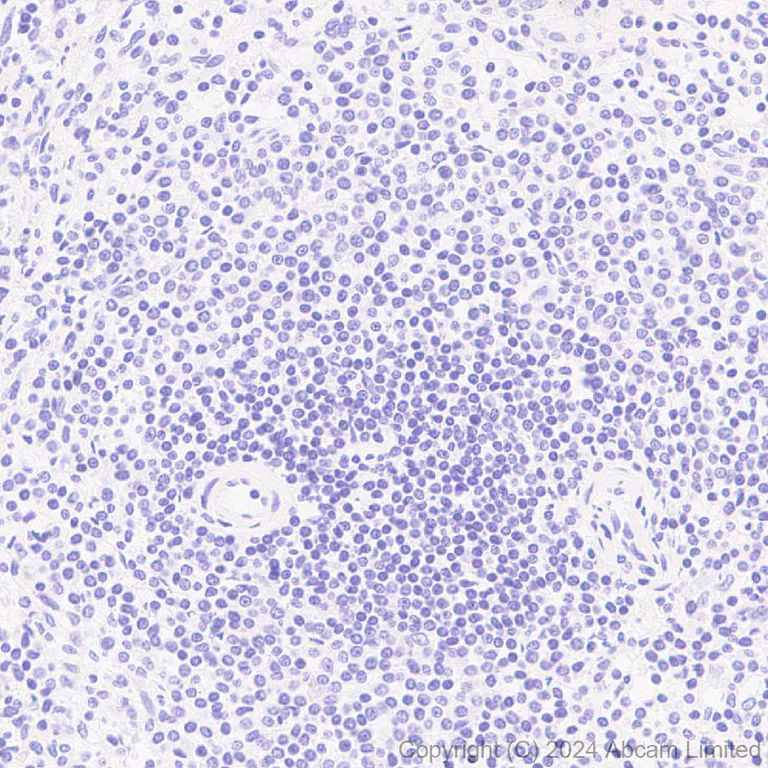 Immunohistochemistry (Formalin/PFA-fixed paraffin-embedded sections) - Anti-REG1B antibody [EPR28864-4] (AB323315)