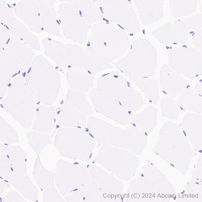 Immunohistochemistry (Formalin/PFA-fixed paraffin-embedded sections) - Anti-REG1B antibody [EPR28864-4] (AB323315)