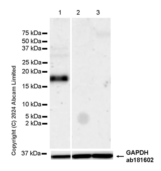 Western blot - Anti-REG1B antibody [EPR28864-4] (AB323315)