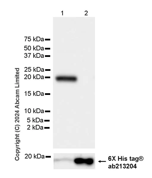 Western blot - Anti-REG1B antibody [EPR28864-4] (AB323315)
