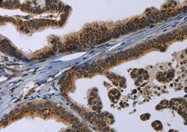 Immunohistochemistry (Formalin/PFA-fixed paraffin-embedded sections) - Anti-Reg3a antibody (AB198824)