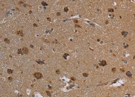Immunohistochemistry (Formalin/PFA-fixed paraffin-embedded sections) - Anti-Reg3a antibody (AB198824)