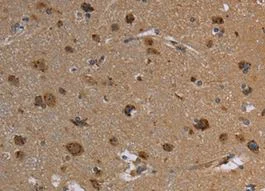 Immunohistochemistry (Formalin/PFA-fixed paraffin-embedded sections) - Anti-Reg3a antibody (AB198824)