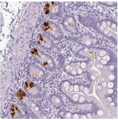 Immunohistochemistry (Formalin/PFA-fixed paraffin-embedded sections) - Anti-Reg3a antibody (AB273132)