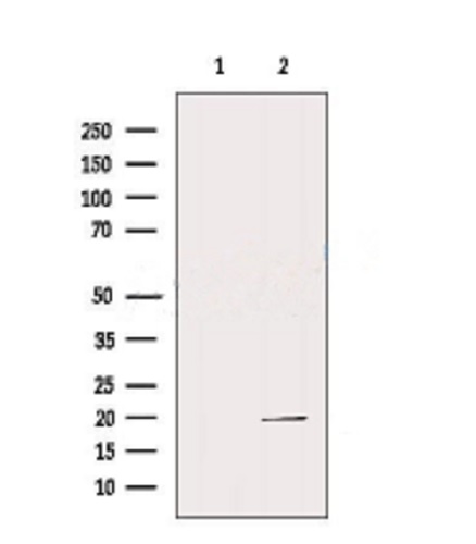 Western blot - Anti-REG3G antibody (AB198216)