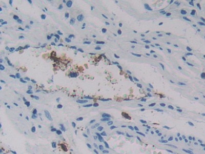 Immunohistochemistry (Formalin/PFA-fixed paraffin-embedded sections) - Anti-REG3G antibody (AB233480), expandable thumbnail