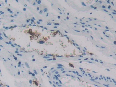 Immunohistochemistry (Formalin/PFA-fixed paraffin-embedded sections) - Anti-REG3G antibody (AB233480)