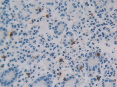 Immunohistochemistry (Formalin/PFA-fixed paraffin-embedded sections) - Anti-REG3G antibody (AB233480), expandable thumbnail