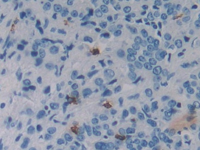 Immunohistochemistry (Formalin/PFA-fixed paraffin-embedded sections) - Anti-REG3G antibody (AB233480), expandable thumbnail
