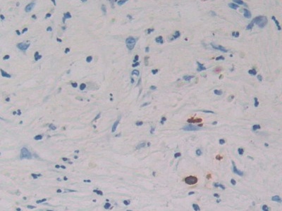Immunohistochemistry (Formalin/PFA-fixed paraffin-embedded sections) - Anti-REG3G antibody (AB233480), expandable thumbnail