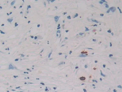 Immunohistochemistry (Formalin/PFA-fixed paraffin-embedded sections) - Anti-REG3G antibody (AB233480)