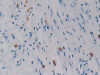 Immunohistochemistry (Formalin/PFA-fixed paraffin-embedded sections) - Anti-REG3G antibody (AB233480), expandable thumbnail