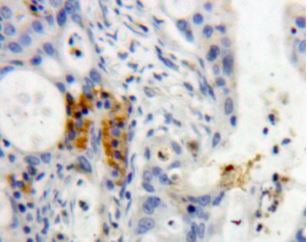 Immunohistochemistry (Formalin/PFA-fixed paraffin-embedded sections) - Anti-REG3G antibody (ab233480), expandable thumbnail