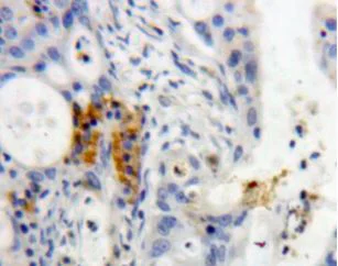 Immunohistochemistry (Formalin/PFA-fixed paraffin-embedded sections) - Anti-REG3G antibody (AB233480)