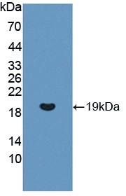 Western blot - Anti-REG3G antibody (ab233480), expandable thumbnail