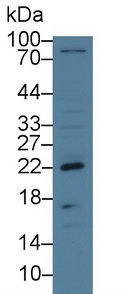 Western blot - Anti-REG3G antibody (ab233480), expandable thumbnail