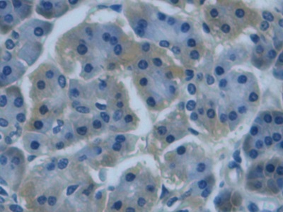 Immunohistochemistry (Formalin/PFA-fixed paraffin-embedded sections) - Anti-REG3G antibody [C13] (AB239610)