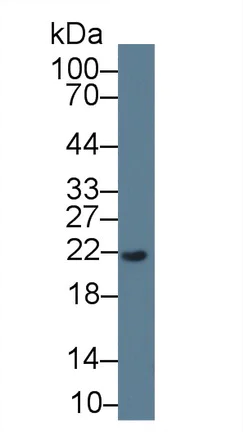 Western blot - Anti-REG3G antibody [C13] (AB239610)