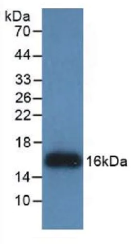 Western blot - Anti-REG3G antibody [C13] (AB239610)