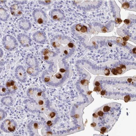 Immunohistochemistry (Formalin/PFA-fixed paraffin-embedded sections) - Anti-REG4 antibody (AB204171)