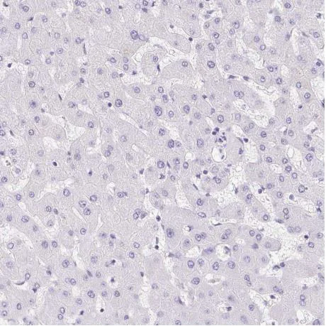 Immunohistochemistry (Formalin/PFA-fixed paraffin-embedded sections) - Anti-REG4 antibody (AB204171)