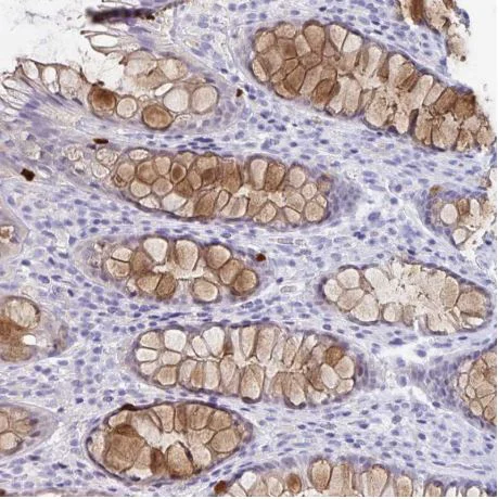 Immunohistochemistry (Formalin/PFA-fixed paraffin-embedded sections) - Anti-REG4 antibody (AB204171)