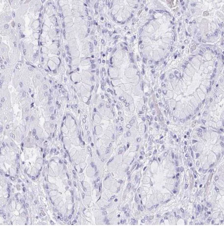 Immunohistochemistry (Formalin/PFA-fixed paraffin-embedded sections) - Anti-REG4 antibody (AB204171)