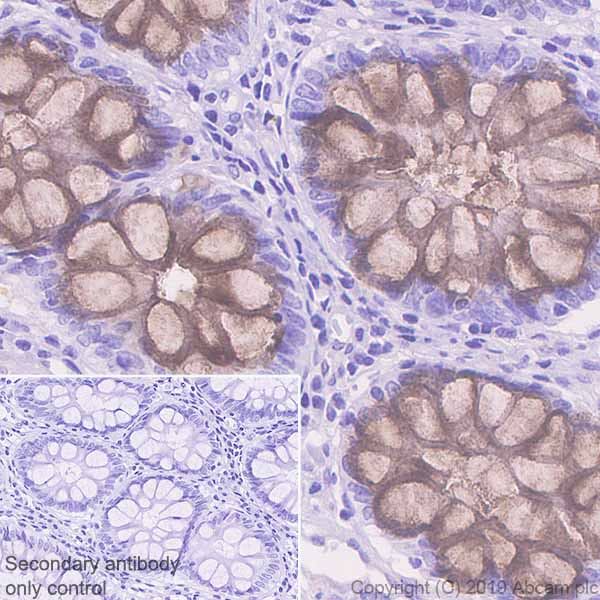 Immunohistochemistry (Formalin/PFA-fixed paraffin-embedded sections) - Anti-REG4 antibody [EPR22810-327] (AB255820)