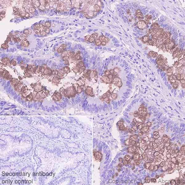 Immunohistochemistry (Formalin/PFA-fixed paraffin-embedded sections) - Anti-REG4 antibody [EPR22810-327] (AB255820)