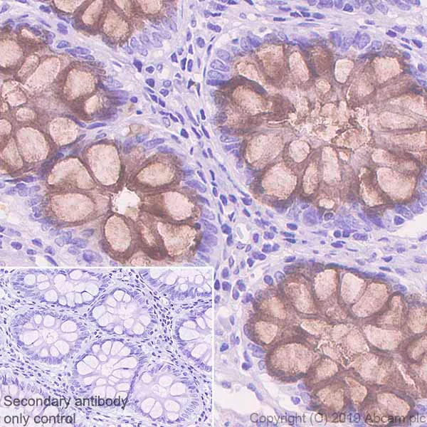 Immunohistochemistry (Formalin/PFA-fixed paraffin-embedded sections) - Anti-REG4 antibody [EPR22810-327] - BSA and Azide free (AB256818)