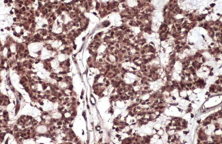Immunohistochemistry (Formalin/PFA-fixed paraffin-embedded sections) - Anti-Rel B antibody (AB154957), expandable thumbnail