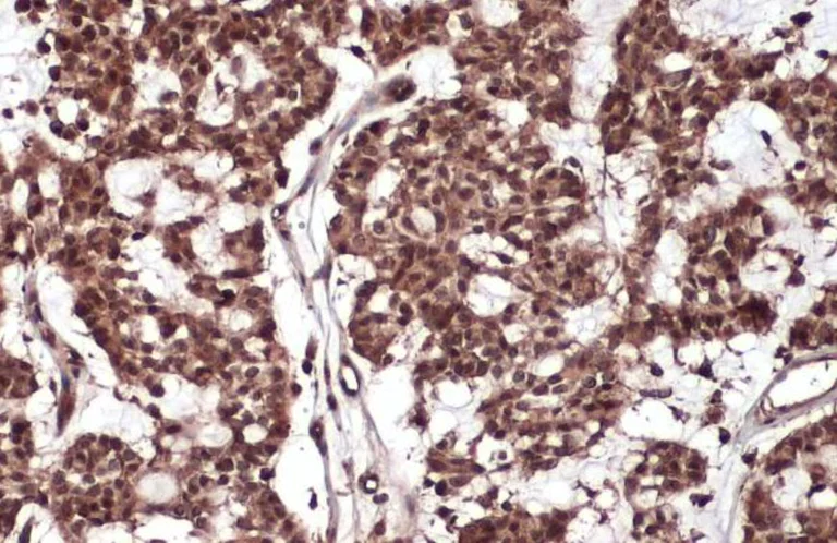 Immunohistochemistry (Formalin/PFA-fixed paraffin-embedded sections) - Anti-Rel B antibody (AB154957)
