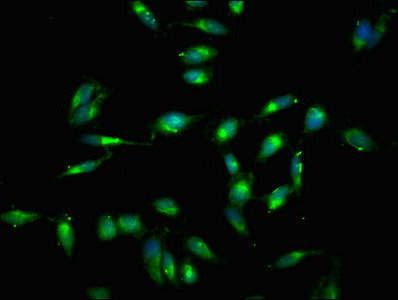 Immunocytochemistry/ Immunofluorescence - Anti-Rel B antibody (AB235922), expandable thumbnail