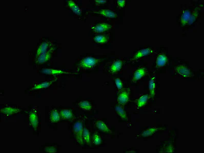 Immunocytochemistry/ Immunofluorescence - Anti-Rel B antibody (AB235922)
