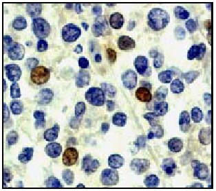 Immunohistochemistry (Formalin/PFA-fixed paraffin-embedded sections) - Anti-Rel B antibody [EP613Y] - BSA and Azide free (AB247280), expandable thumbnail