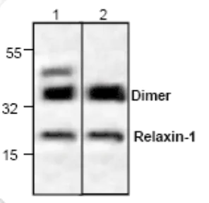 Western blot - Anti-Relaxin 1 antibody (AB70803)