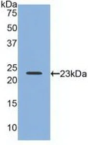 Western blot - Anti-Relaxin 2/RLN2 antibody (AB232707)