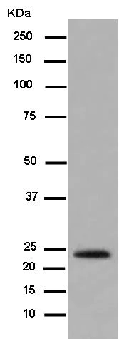 Western blot - Anti-Relaxin 2/RLN2 antibody [EPR14205] (AB183505)