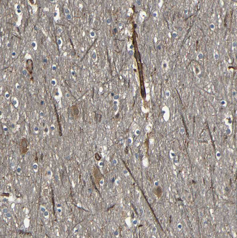 Immunohistochemistry (Formalin/PFA-fixed paraffin-embedded sections) - Anti-RELL1 antibody (ab121394), expandable thumbnail
