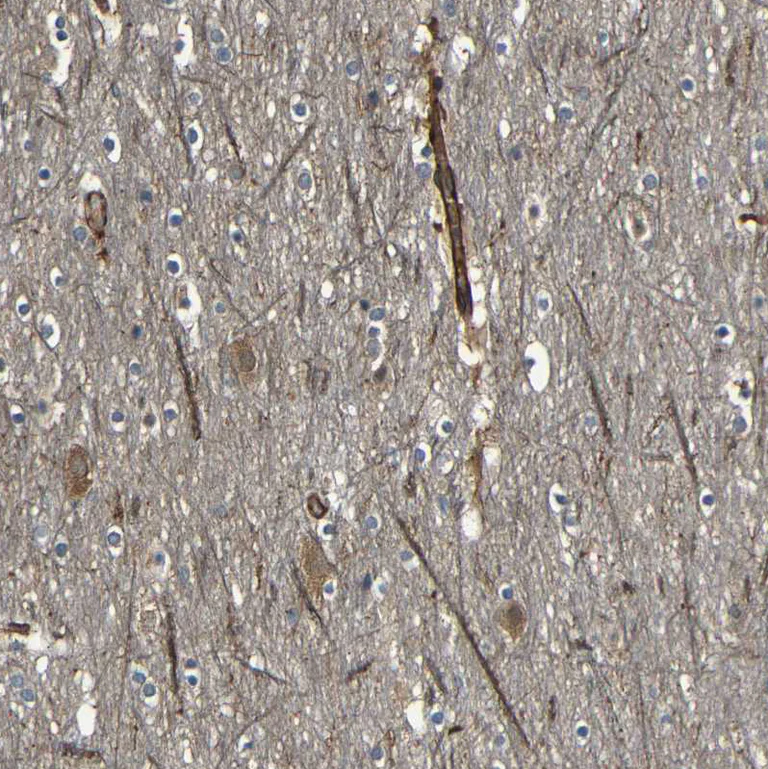 Immunohistochemistry (Formalin/PFA-fixed paraffin-embedded sections) - Anti-RELL1 antibody (AB121394)