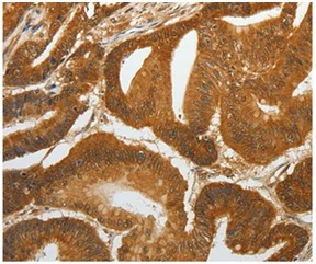 Immunohistochemistry (Formalin/PFA-fixed paraffin-embedded sections) - Anti-RELM beta antibody (AB197361)