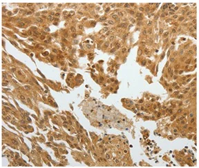 Immunohistochemistry (Formalin/PFA-fixed paraffin-embedded sections) - Anti-RELM beta antibody (AB197361)