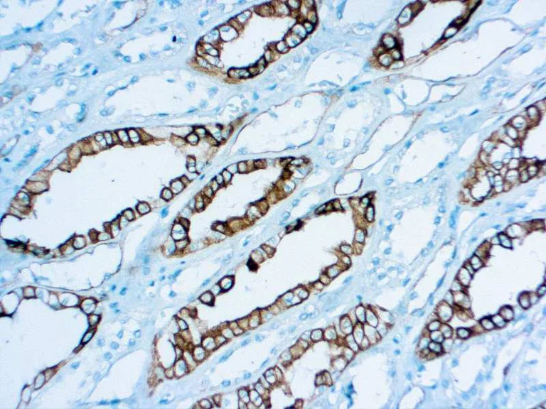Immunohistochemistry (Formalin/PFA-fixed paraffin-embedded sections) - Anti-Renal Cell Carcinoma (gp200) antibody [PN-15] (AB277482)