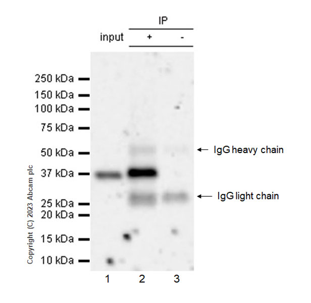 Immunoprecipitation - Anti-Renalase antibody [EPR25655-163] (AB314303), expandable thumbnail