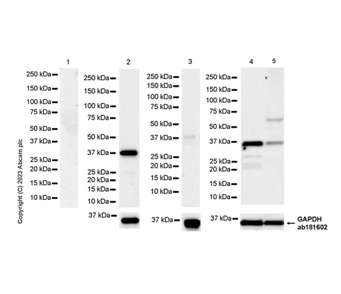 Western blot - Anti-Renalase antibody [EPR25655-163] (AB314303), expandable thumbnail
