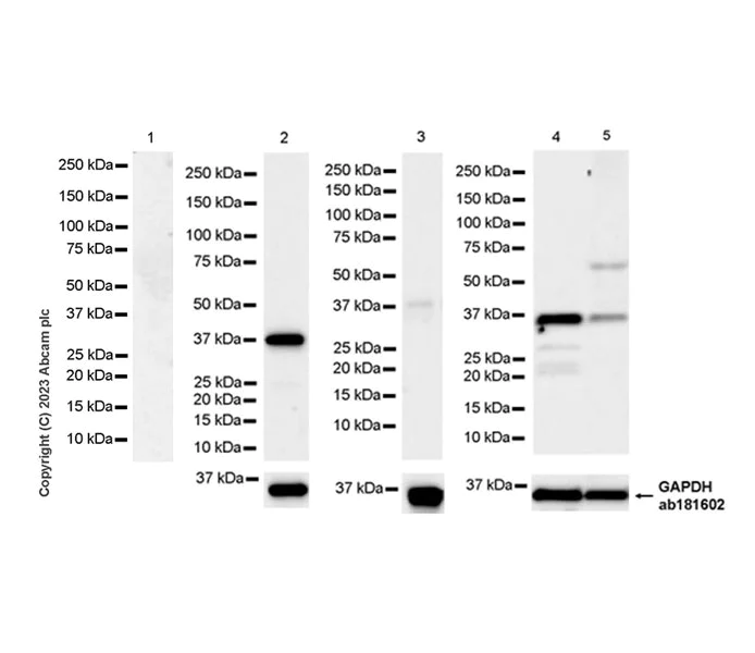 Western blot - Anti-Renalase antibody [EPR25655-163] (AB314303)
