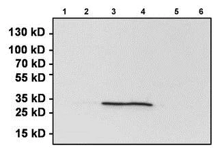 Immunoprecipitation - Anti-Renilla Luciferase antibody (AB187338)