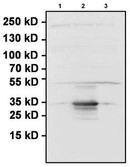 Western blot - Anti-Renilla Luciferase antibody (AB187338)