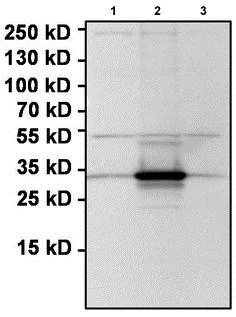Western blot - Anti-Renilla Luciferase antibody (AB187338)