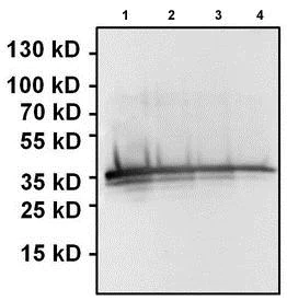 Western blot - Anti-Renilla Luciferase antibody (AB187338)